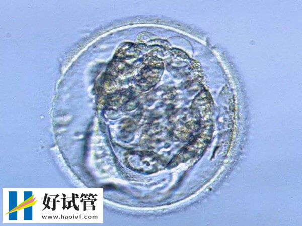 扳机日孕酮高于1.5ng/mL不能做鲜胚移植吗？(图1)